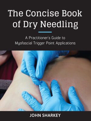 The Concise Book of Dry Needling - ebook